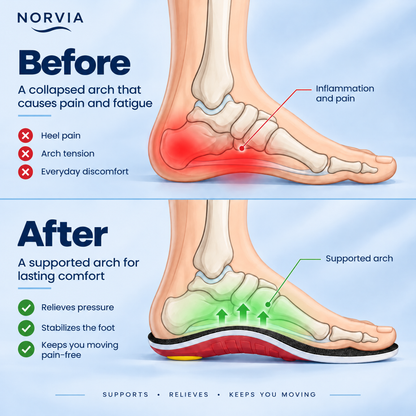 Norvia™ Walk Pain-Free — From Morning to Night